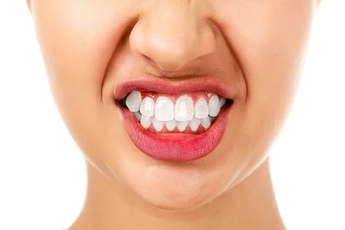 Woman grinding teeth bruxism