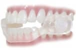 SleepRight Slim-Comfort Dental Guard Review