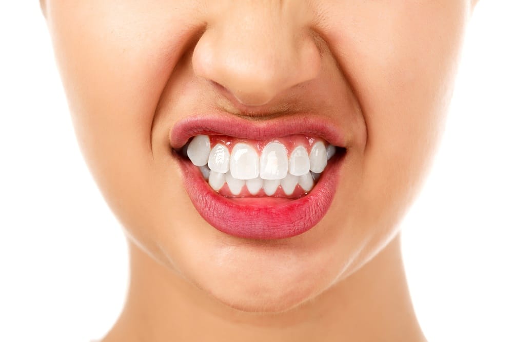 What is Bruxism and what can I do about it?