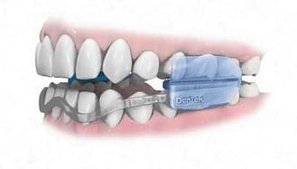 Dentek Comfort Fit Dental Guard Review Best Night Sleep Ever