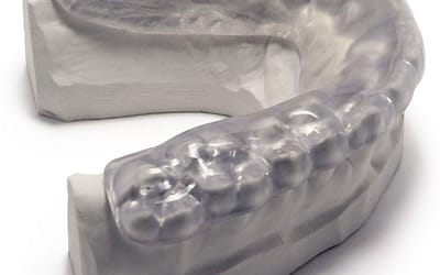 Pro Teeth Guard – Custom Dental Night Guard for Teeth Grinding