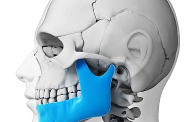 Finding The Best Mouth Guard For TMJ Night Grinding