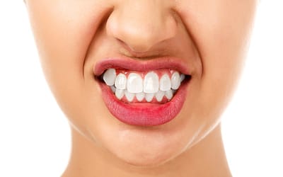 What is Bruxism and what can I do about it?